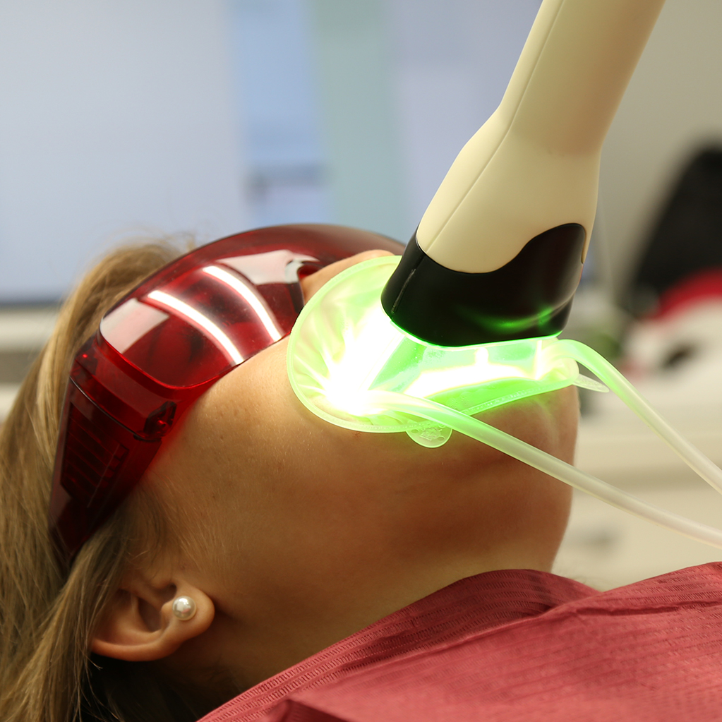 Правильное отбеливание зубов