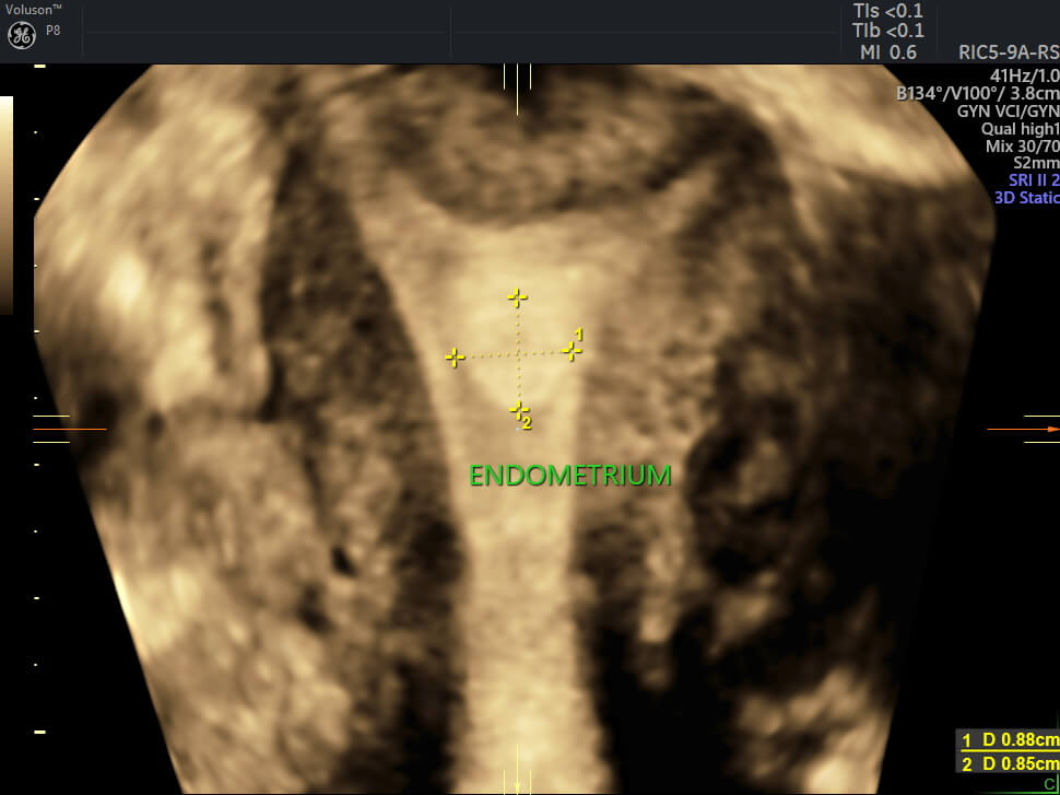 Ескі ана секс видео