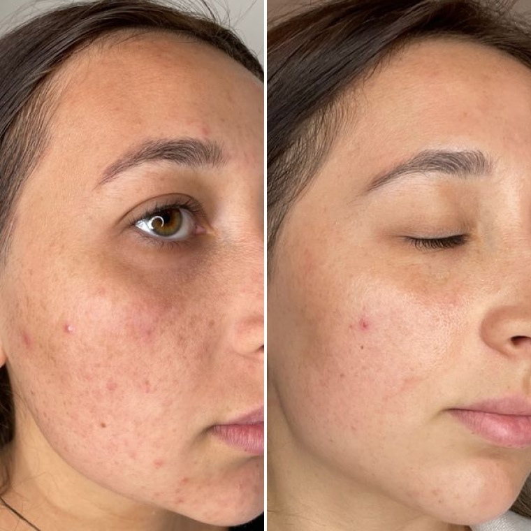 Марина — до і після використання Ceramide Complex+