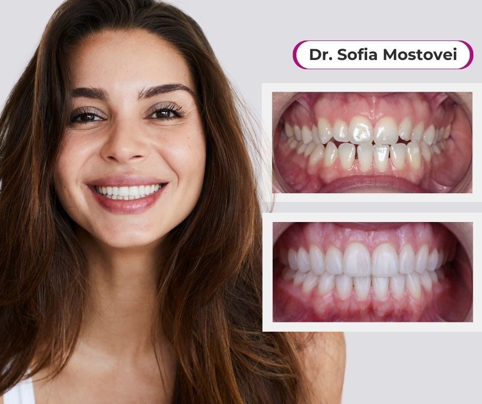 Dr. Sofia Mostovei - ortodont Chisinau
