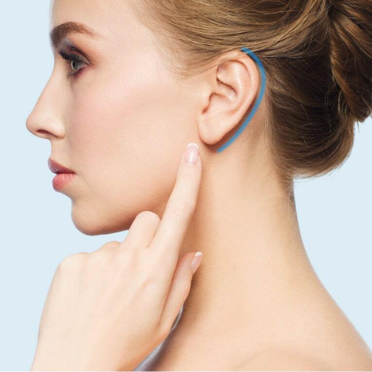 Отопластика пластика вушних раковин