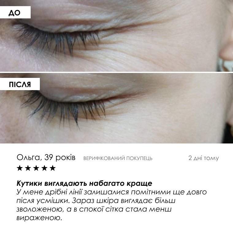 Інтенсивний комплекс проти «гусячих лапок» — сироватка 20 g і крем 35 g, фото 8 з 9