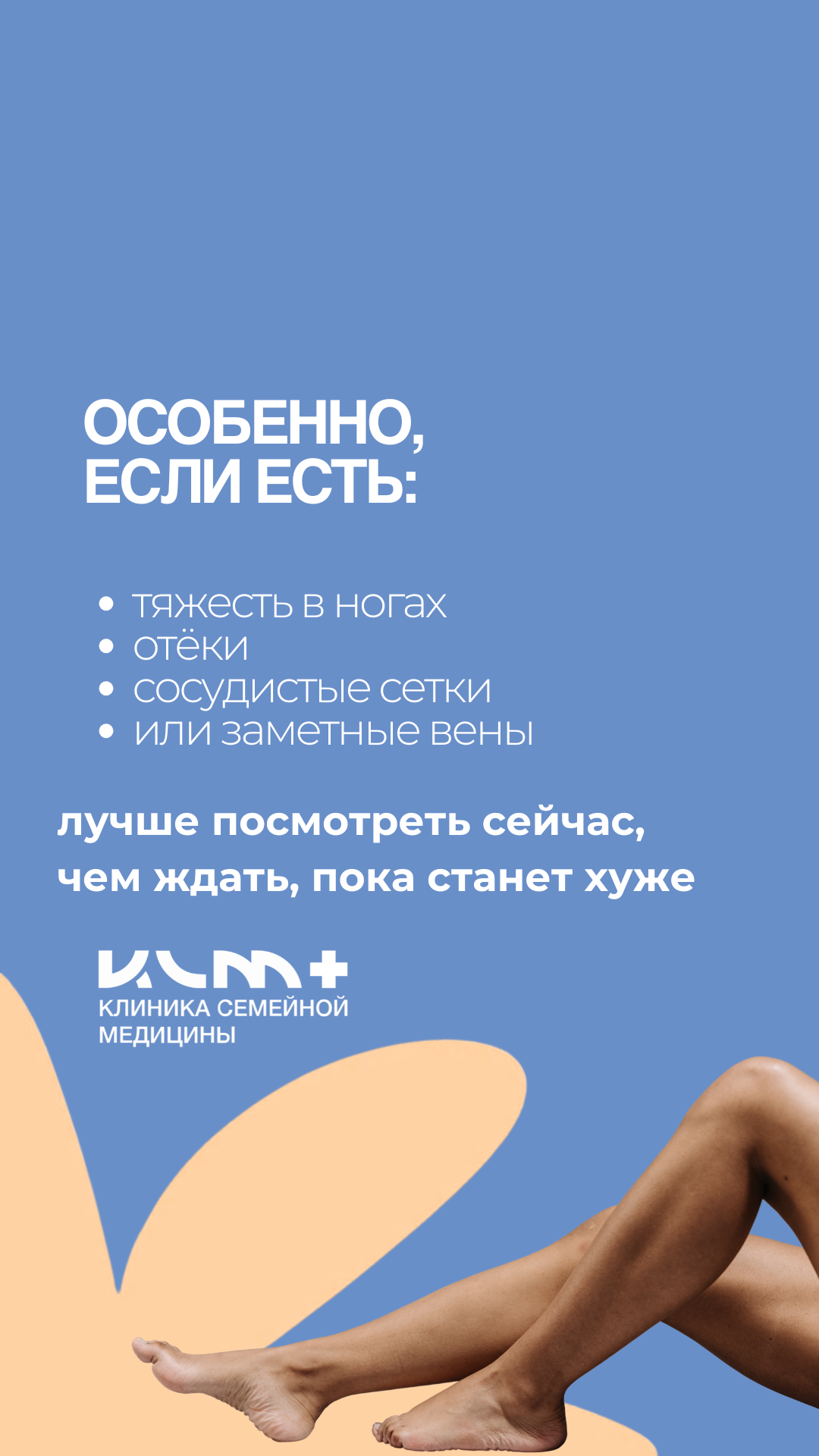 Симптомы варикоза