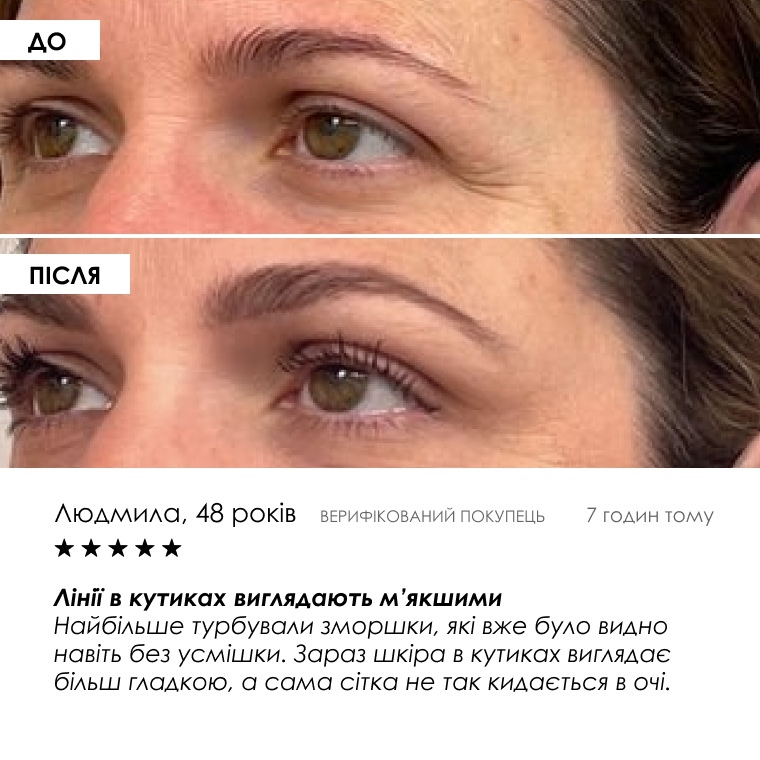 Інтенсивний комплекс проти «гусячих лапок» — сироватка 20 g і крем 35 g, фото 7 з 9