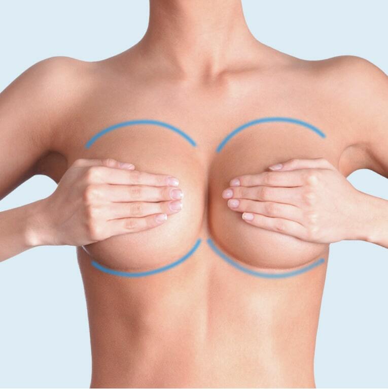 Маммопластика - пластика груди
