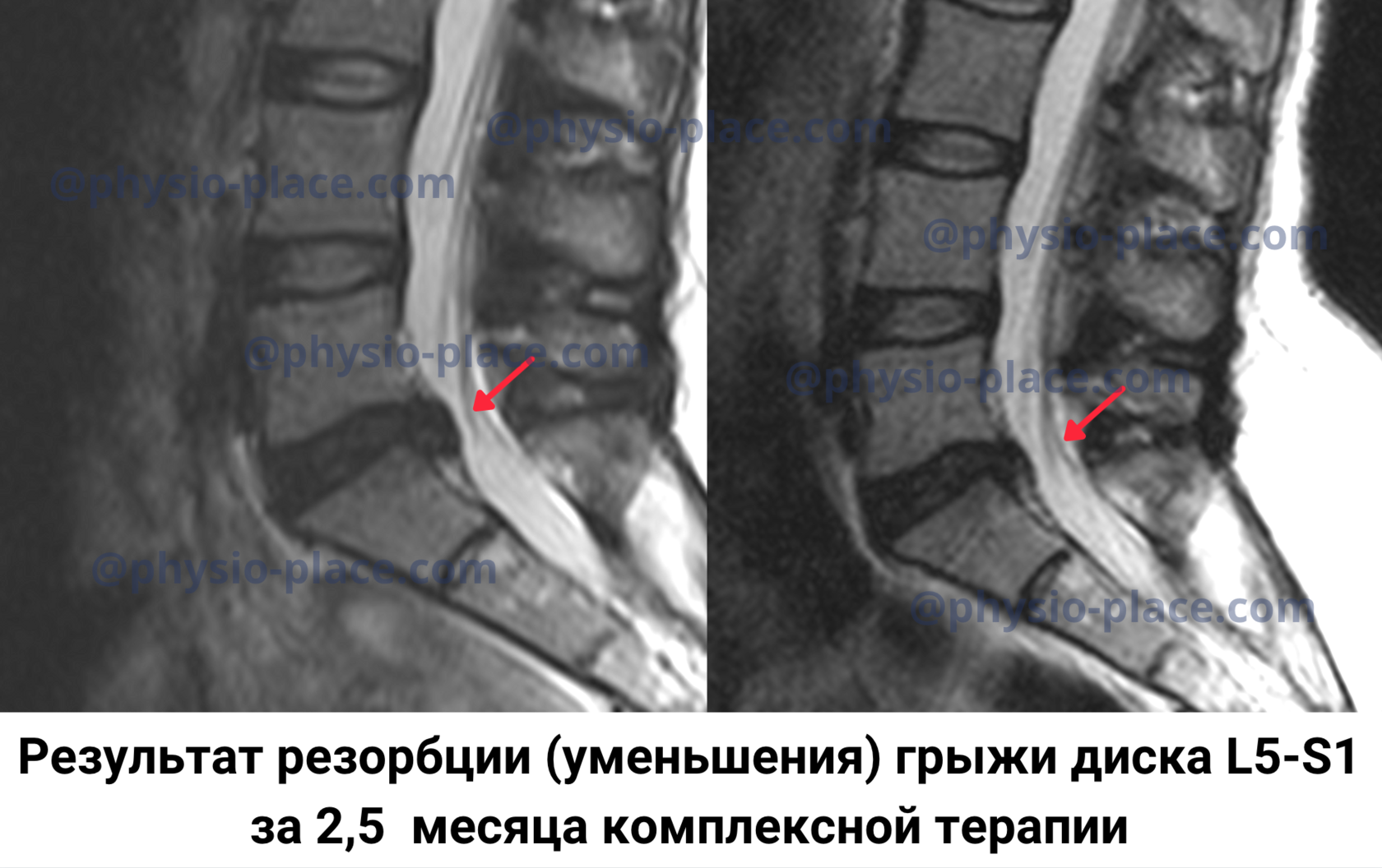 Вызов реабилитолога на дом в Киеве